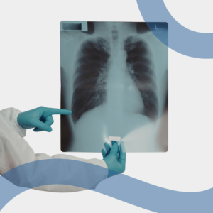 immagine radiografia polmone