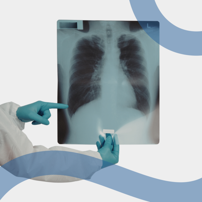 immagine radiografia polmone