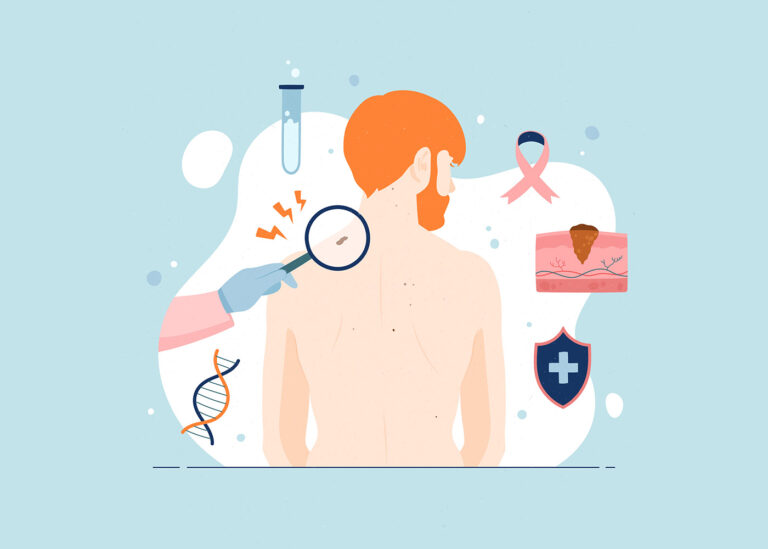 prevenzione per il tumore della pelle